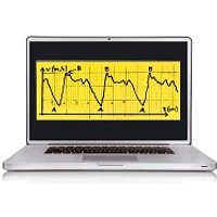 Swimsportec PC-Software "Bio SwimAnalysis"